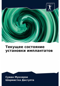 Текущее состояние установки имплантатов