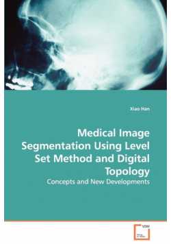 Medical Image Segmentation Using Level Set Method and Digital Topology - Concepts and New Developments