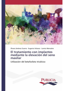 El tratamiento con implantes mediante la elevación del seno maxilar