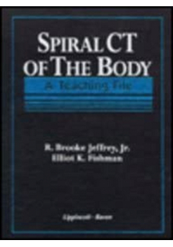 Spiral CT of the body