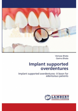 Implant supported overdentures