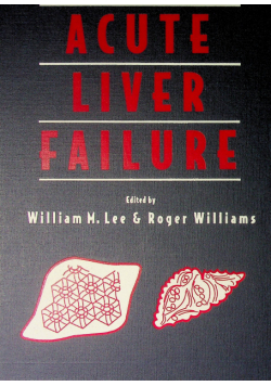 Acute Liver failure