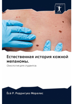 Естественная история кожной меланомы.