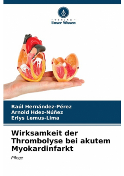 Wirksamkeit der Thrombolyse bei akutem Myokardinfarkt