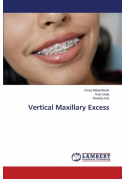 Vertical Maxillary Excess