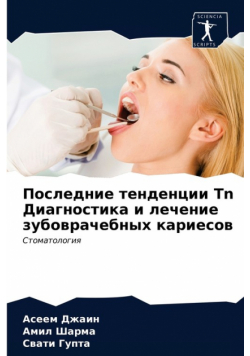 Последние тенденции Tn Диагностика и лечение зубоврачебных кариесов