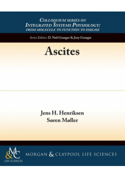Ascites
