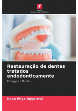 Restauração de dentes tratados endodonticamente