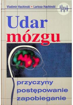 Udar mózgu