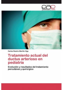 Tratamiento actual del ductus arterioso en pediatría