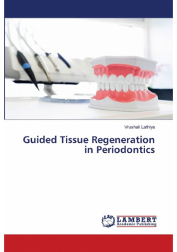 Guided Tissue Regeneration in Periodontics