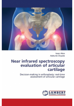 Near infrared spectroscopy evaluation of articular cartilage