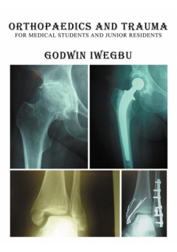 Orthopaedics and Trauma for Medical Students and Junior Residents