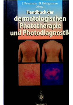Handbuch der dermatologischen Phototherapie und Photodiagnostik