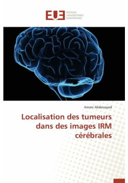 Localisation des tumeurs dans des images irm cérébrales