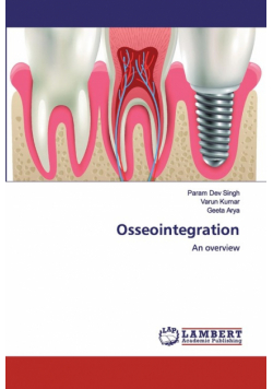 Osseointegration
