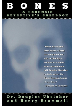 Bones