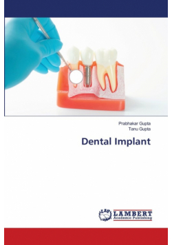 Dental Implant