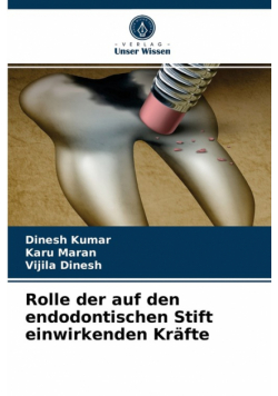 Rolle der auf den endodontischen Stift einwirkenden Kräfte