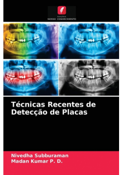 Técnicas Recentes de Detecção de Placas