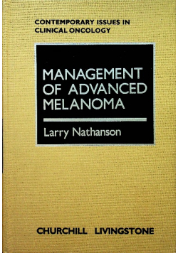Management of advanced melanoma