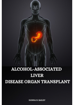 Alcohol-associated liver disease organ transplant