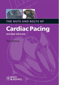 Nuts Bolts Cardiac Pacing 2e