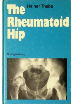 The reumatoid hip
