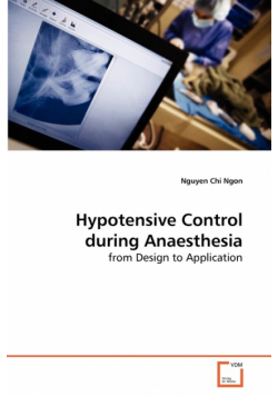 Hypotensive Control during Anaesthesia