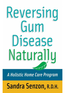 Reversing Gum Disease Naturally