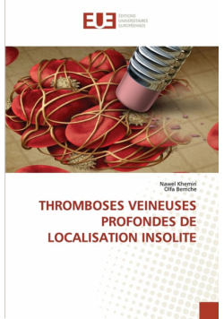 Thromboses Veineuses Profondes De Localisation Insolite