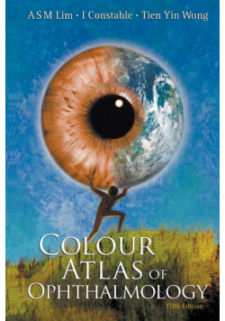 Colour Atlas of Ophthalmology