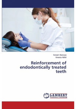 Reinforcement of endodontically treated teeth