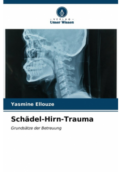 Schädel-Hirn-Trauma