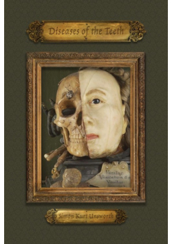 Diseases of the Teeth