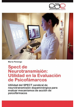 Spect de Neurotransmisión
