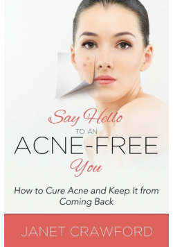Say Hello to an Acne-Free You