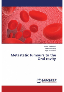 Metastatic tumours to the Oral cavity