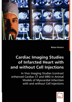 Cardiac Imaging Studies of Infarcted Heart with and without Cell Injections