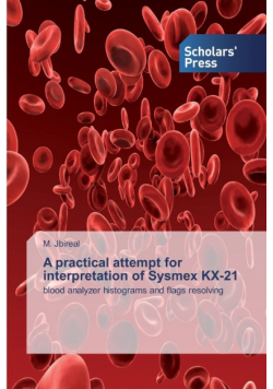 A practical attempt for interpretation of Sysmex KX-21