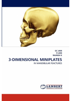 3-Dimensional Miniplates