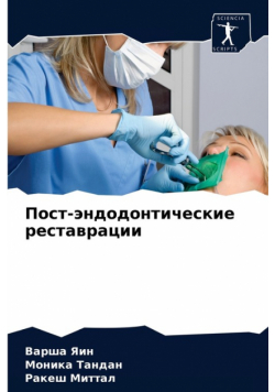 Пост-эндодонтические реставрации