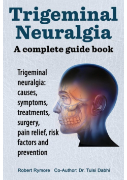 Trigeminal neuralgia