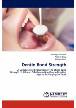 Dentin Bond Strength
