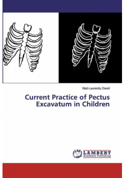 Current Practice of Pectus Excavatum in Children