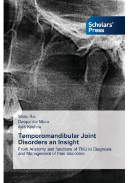 Temporomandibular Joint Disorders an Insight