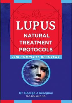 Lupus