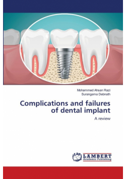 Complications and failures of dental implant