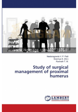 Study of surgical management of proximal humerus