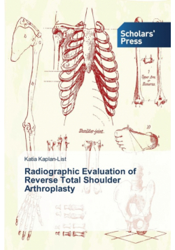 Radiographic Evaluation of Reverse Total Shoulder Arthroplasty